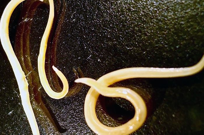 Infeksi Cacing GelangPenyebab Kematian Raya