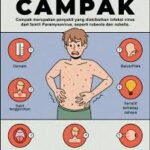 Kasus Campak Meningkat, Begini yang Dilakukan Dinkes Jabar